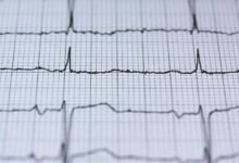 velocity growth pulse edge
